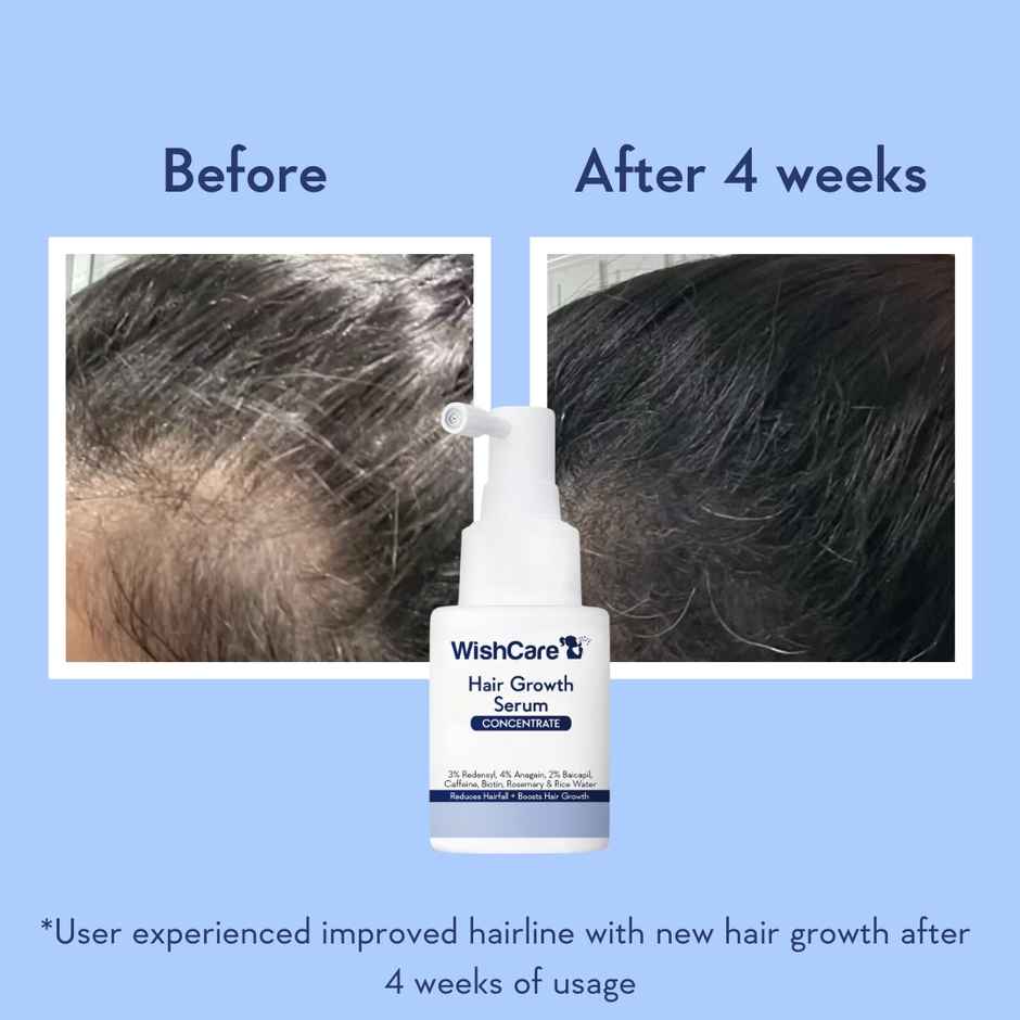 WishCare Hair Growth Serum Concentrate-Resdensyl,Anagain,Caffeine,Biotin, Keratin & Rice Water
