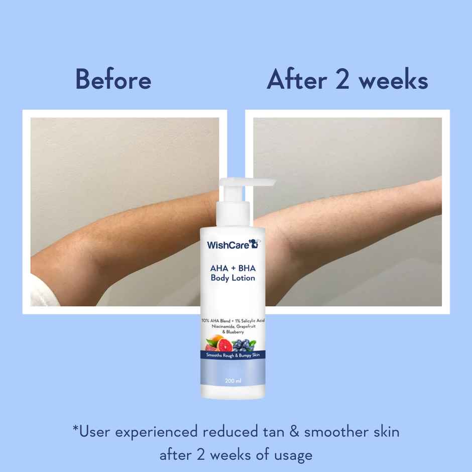 WishCare 10% AHA + 1% BHA Body Lotion | Smooths Rough & Bumpy Skin | With Grapefruit & Blueberry