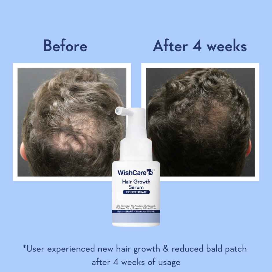 WishCare Hair Growth Serum Concentrate-Resdensyl,Anagain,Caffeine,Biotin, Keratin & Rice Water