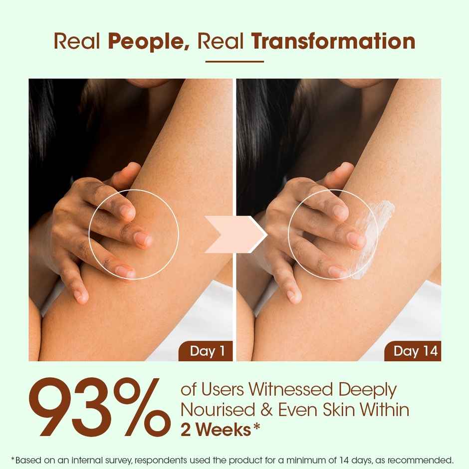 The Ayurveda Co. Intense Hydration Body Lotion With Aloe Vera & Shea Butter