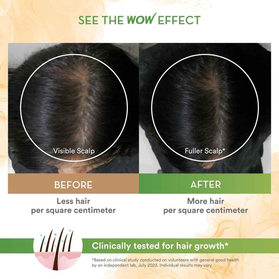 Wow Skin Science Rosemary & Biotin Hair Growth Shampoo