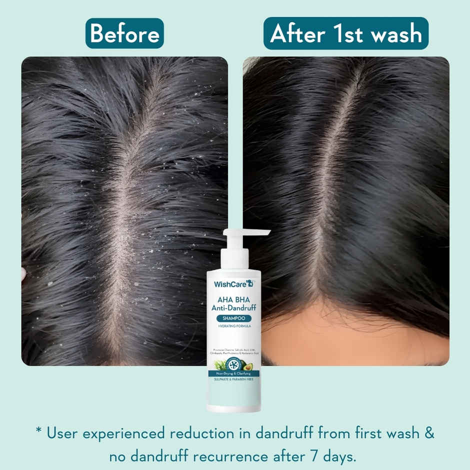 WishCare Hydrating AHA BHA Anti Dandruff Shampoo | 100% Dandruff Reduction|Paraben & Sulphate Free