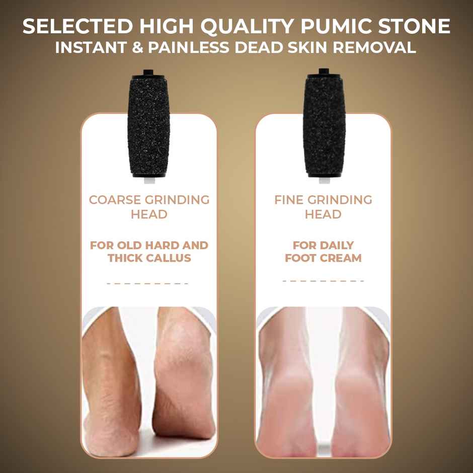 Winston Callus Remover For Feet For Men And Women