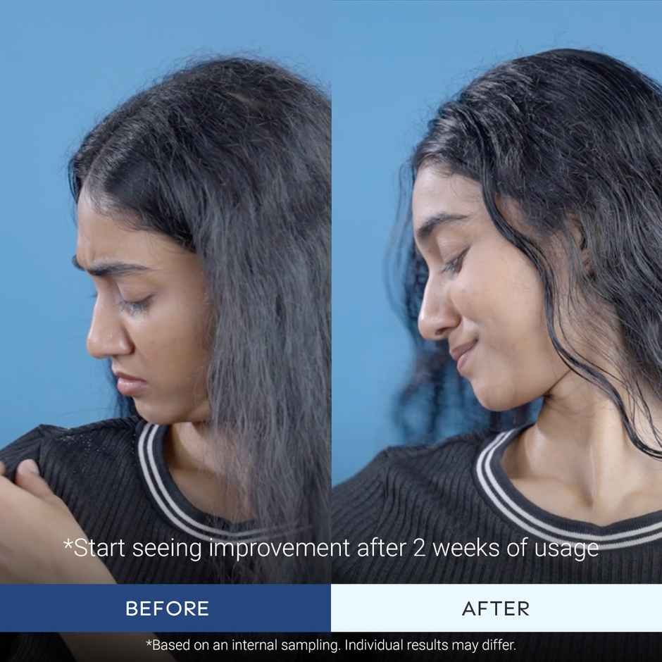 Arata Anti-Dandruff Shampoo with Piroctone Olamine & Salicylic Acid for Dandruff Reduction