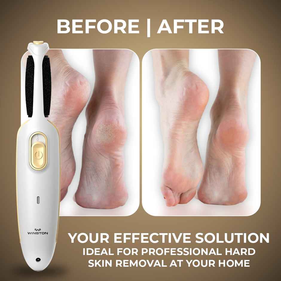 Winston Callus Remover For Feet For Men And Women
