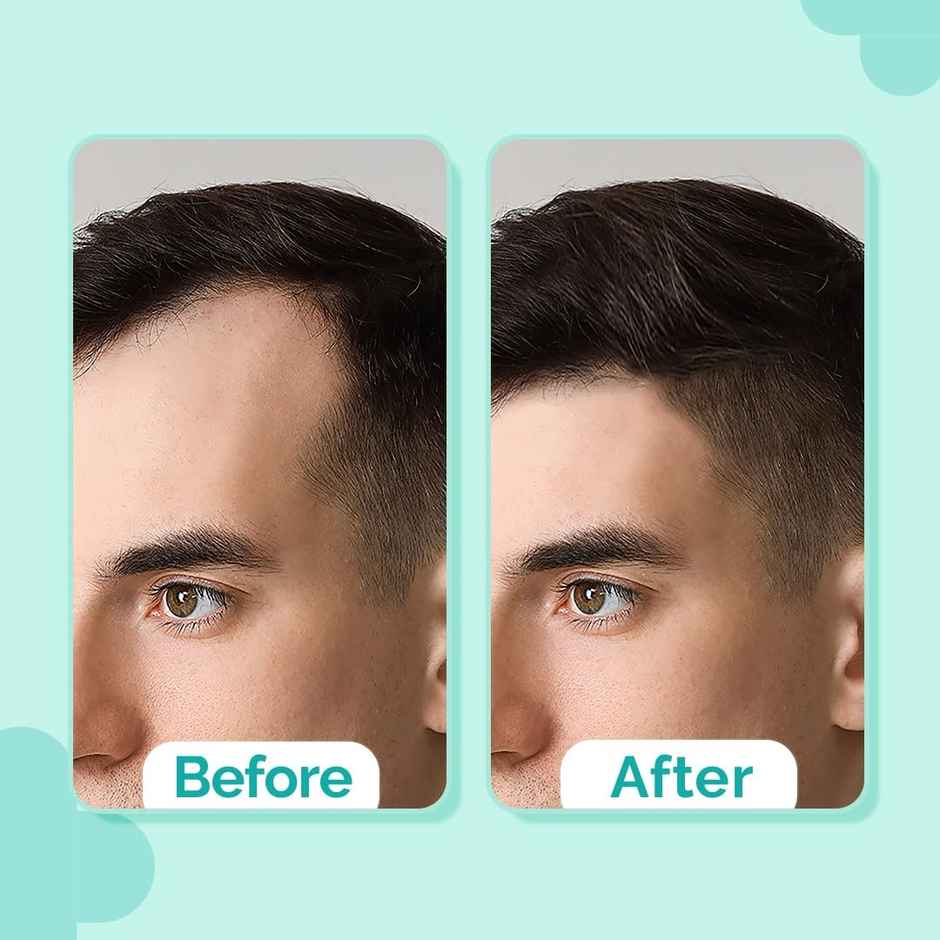 The Derma Co 20% Actives Peptide-Stem Cell Hair Growth Serum with Foligen Analupe & Anagain