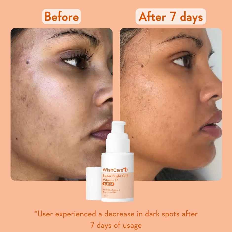 WishCare Super Bright C16 Vitamin C Face Serum | 10% Vitamin C & Niacinamide | Reduces Pigmentation