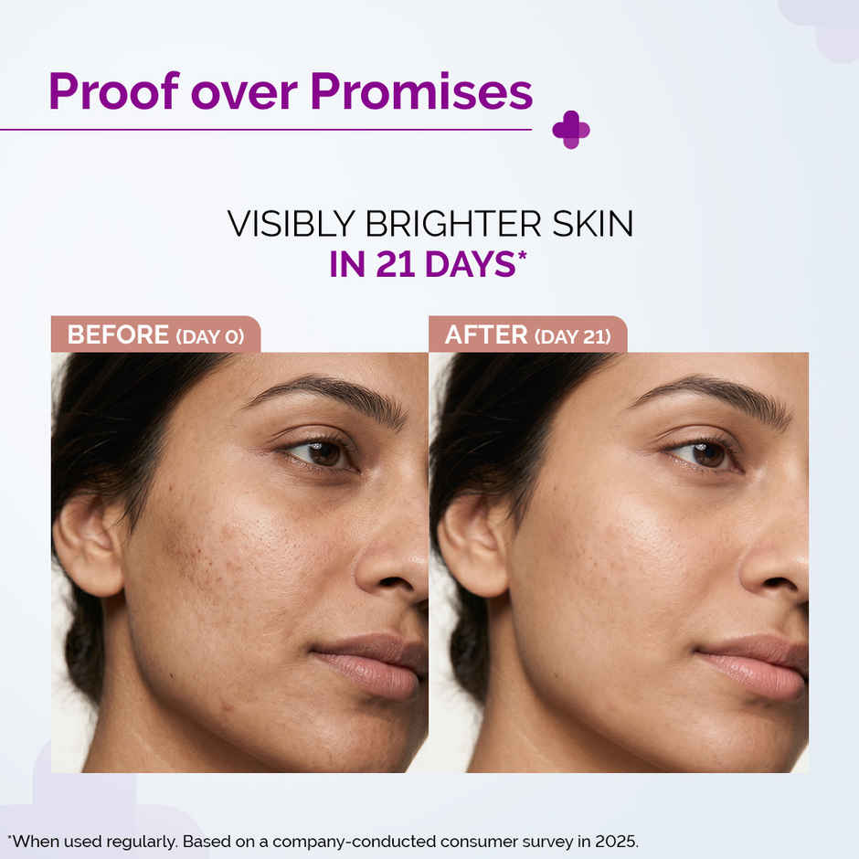 The Derma Co 10% Vitamin C Face Serum Reduces Pigmentation & Glowing Skin For All Skin Types