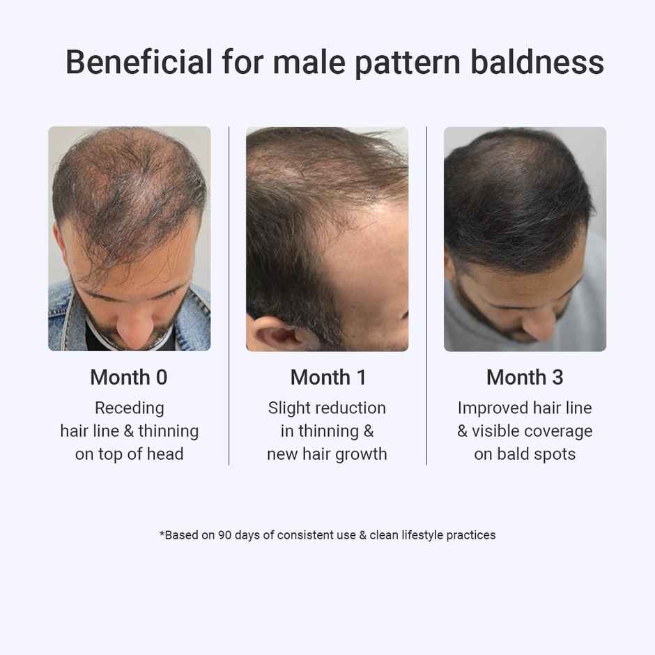 Arata 3% Redensyl & 3% Procapil Hair Growth Serum