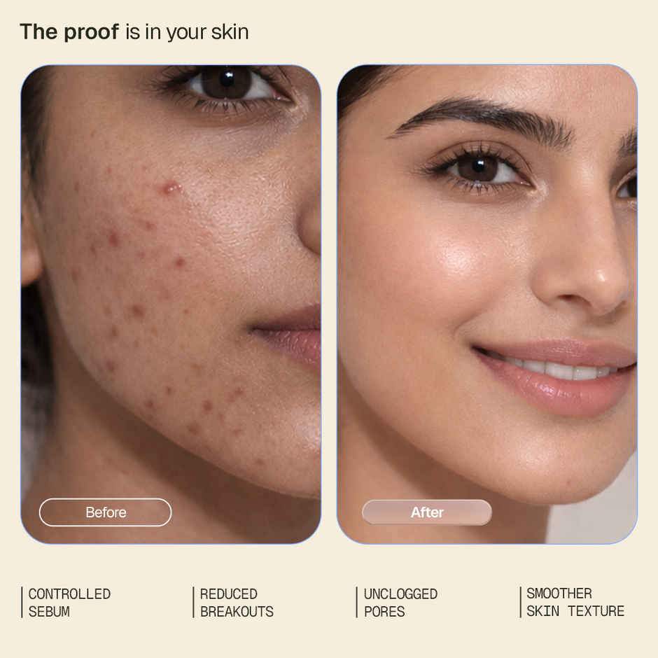 Arata Oil-Control Face Wash | 1% Salicylic Acid | Reduces Acne | Sulphate-Free