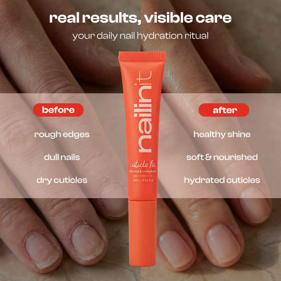 Nailinit Cuticle Fix Cuticle Oil | Hydrating & Nourishing Cuticle Oil