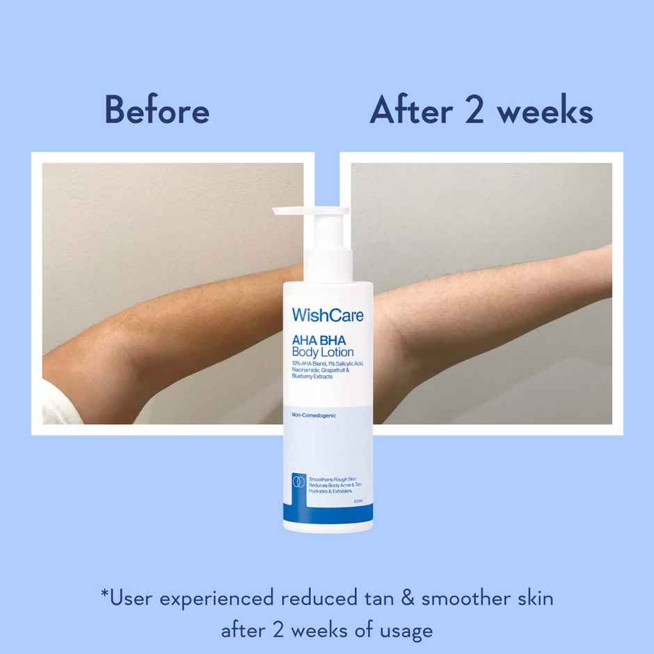 WishCare 10% AHA + 1% BHA Body Lotion | Smooths Rough & Bumpy Skin | With Grapefruit & Blueberry