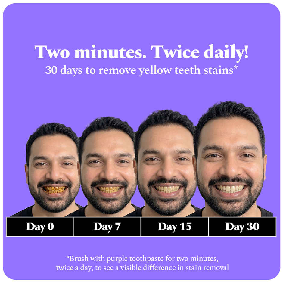 Perfora Purple Magic Whitening Toothpaste