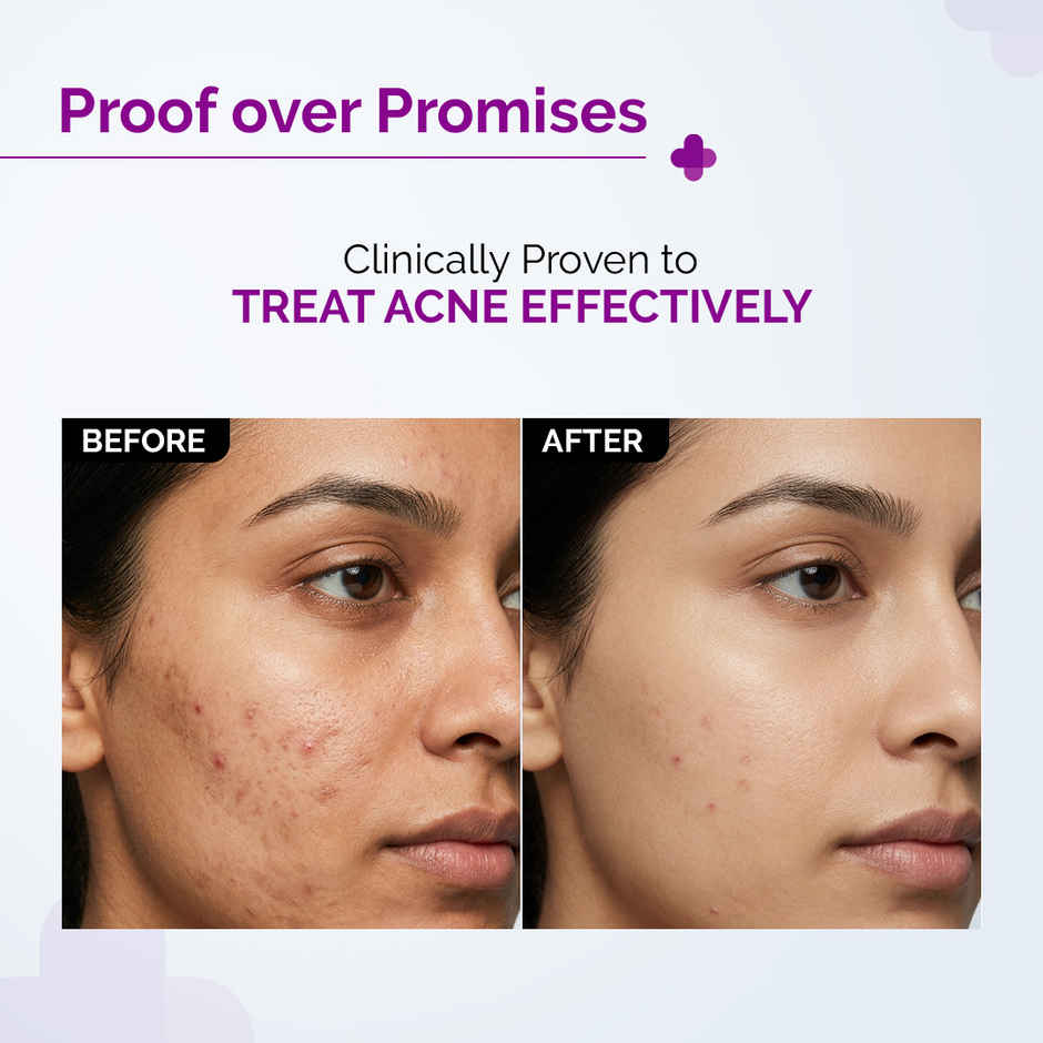 The Derma Co 2% Salicylic Acid Face Serum