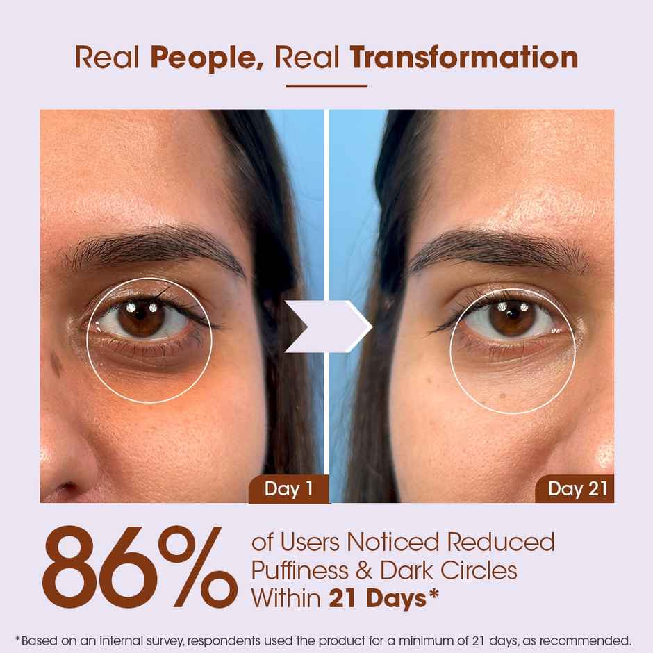 TAC Bakuchiol Under Eye Gel Cream With Retinol For Dark Circles & Wrinkles