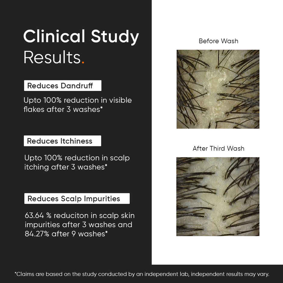 Minimalist Anti-Dandruff Shampoo