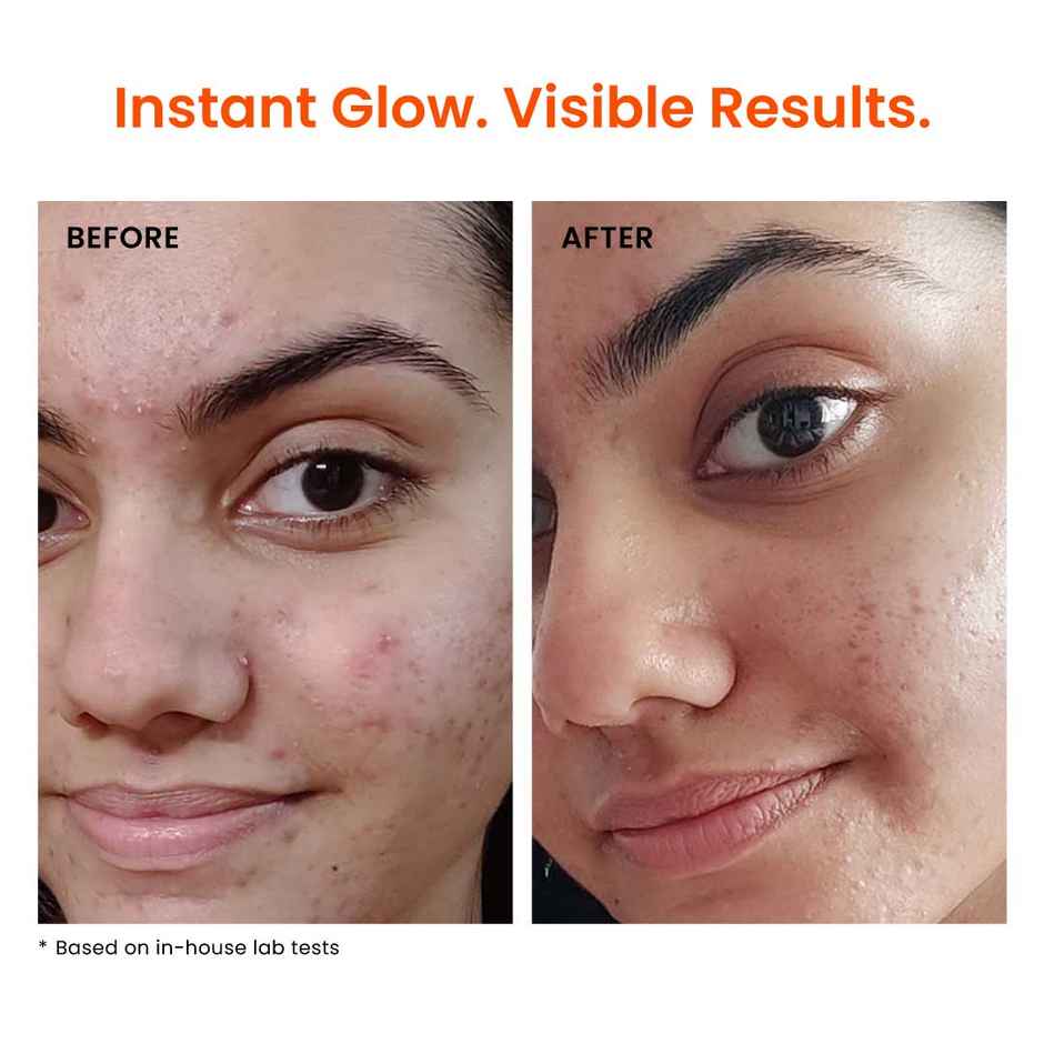 Foxtale 12% Niacinamide Serum with Azelaic Acid for Oil Control & Brightening