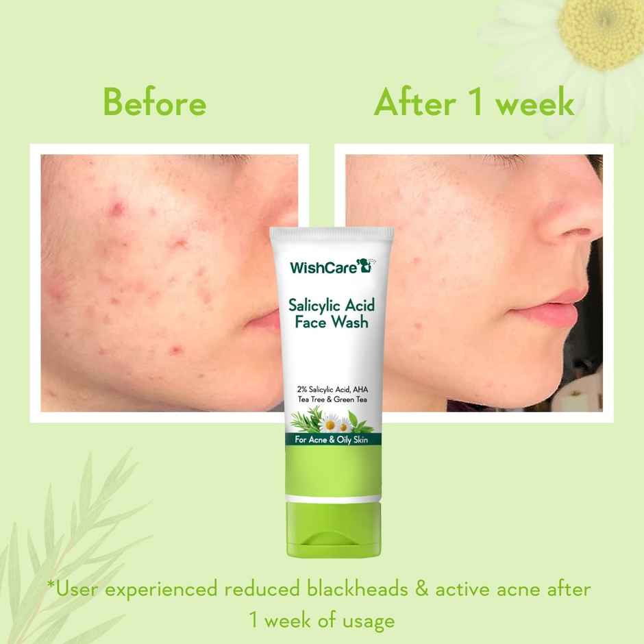 Wishcare 2% Salicylic Acid Face Wash With Aha, Greentea, Chamomile & Teatree