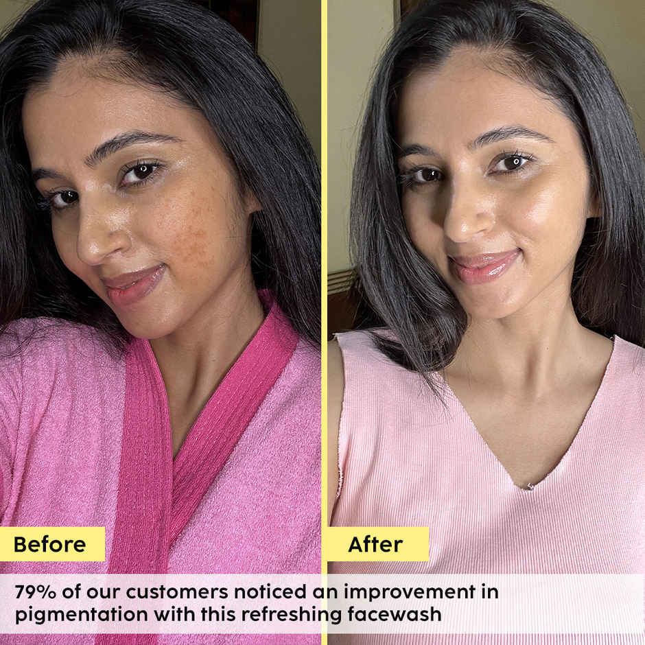 Plix Pineapple Juicy Cleanser with Niacinamide for De-pigmentation