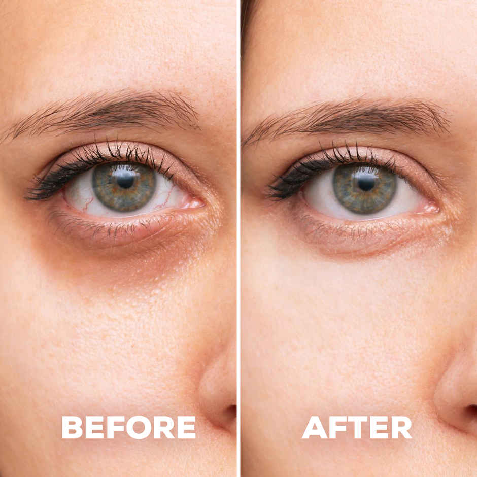 Gleva Cooling Eye Gel Mask for Dark Circles | Pain Relief | Redness | Eye Patches For Women & Men
