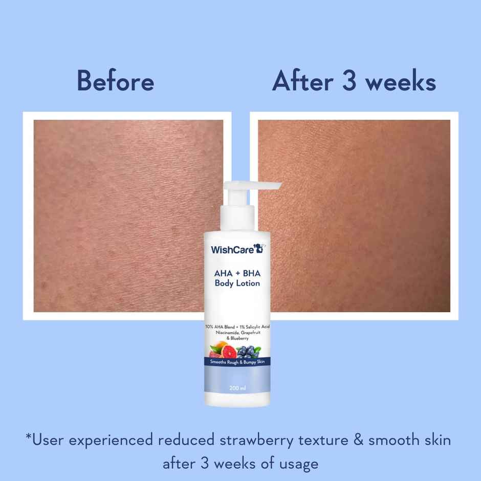 Wishcare Spf50 Niacinamide Sunscreen Body Lotion With No White Cast (200g) & Wishcare 10% Aha + 1% Bha Body Lotion With Niacinamide - Smooths Rough  Bumpy Skin (200g) Combo