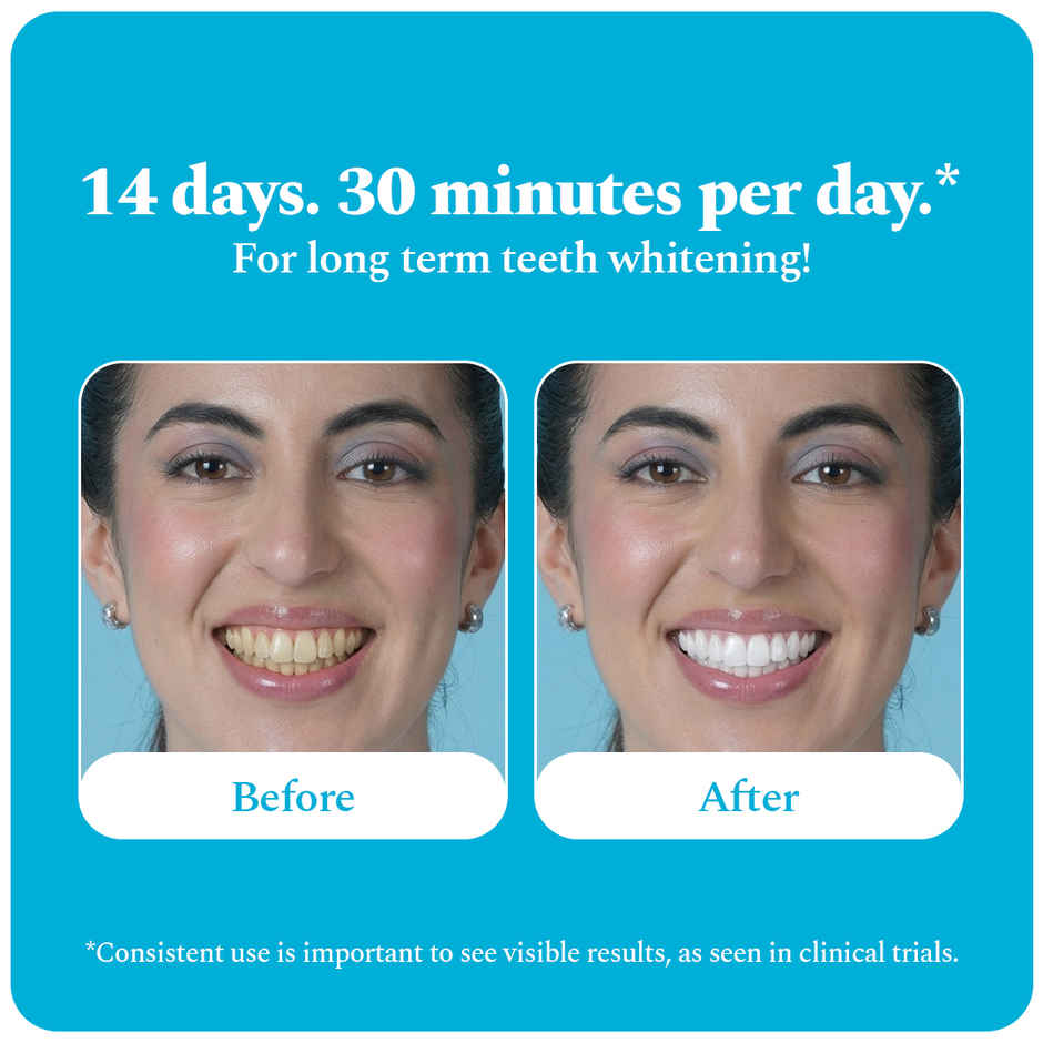 Perfora Teeth Whitening Strips | Classic Mint