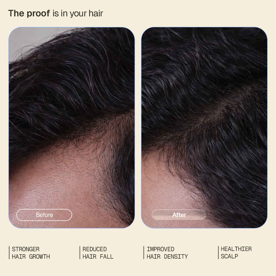 Arata Hair Growth Intensive Serum with 3% Redensyl