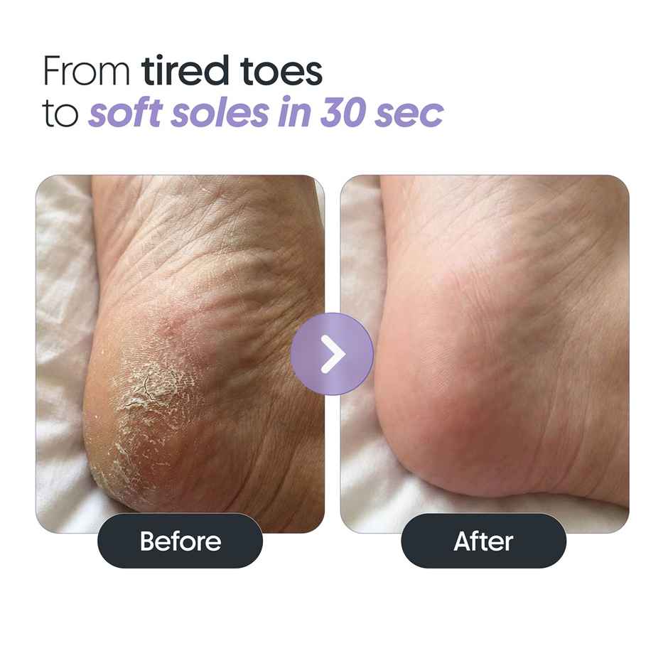 FURR Instant Pedicure Spray