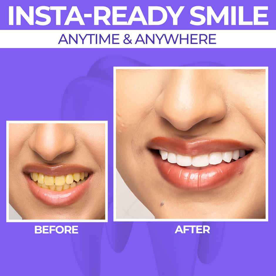 Sanfe Purple Teeth Whitening Gel Color Corrector | Instant Whitening