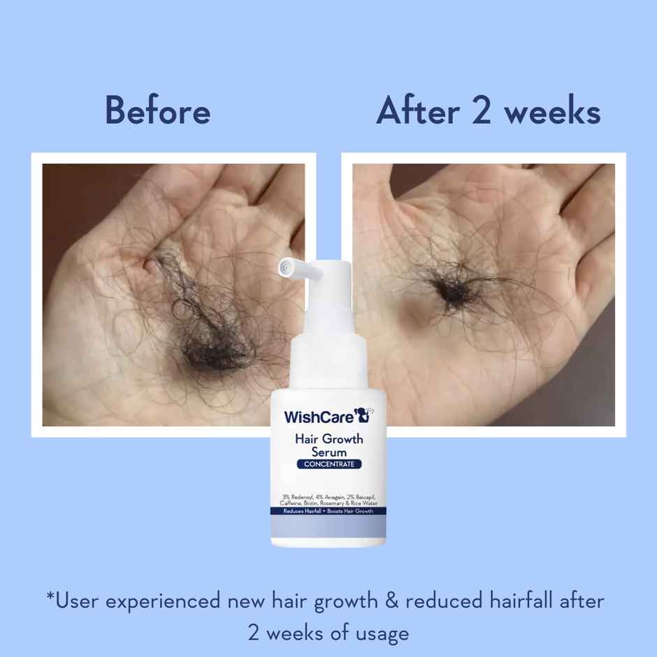 WishCare Hair Growth Serum Concentrate-Resdensyl,Anagain,Caffeine,Biotin, Keratin & Rice Water