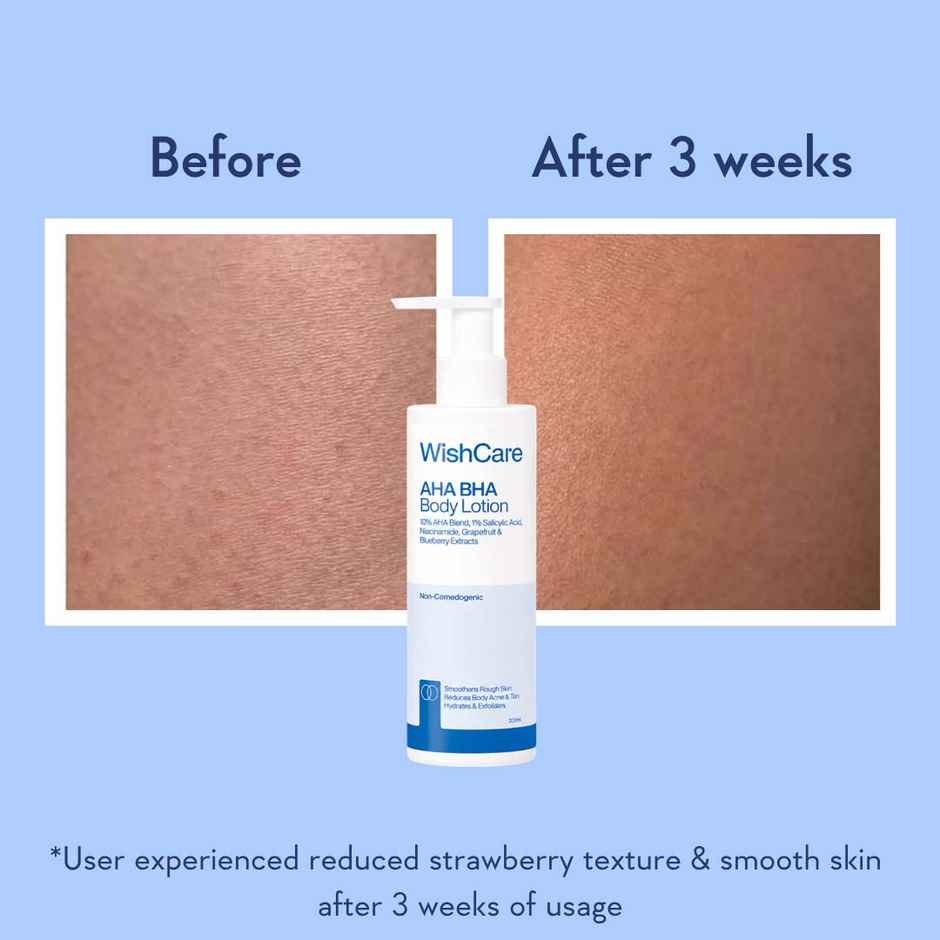 WishCare 10% AHA + 1% BHA Body Lotion | Smooths Rough & Bumpy Skin | With Grapefruit & Blueberry