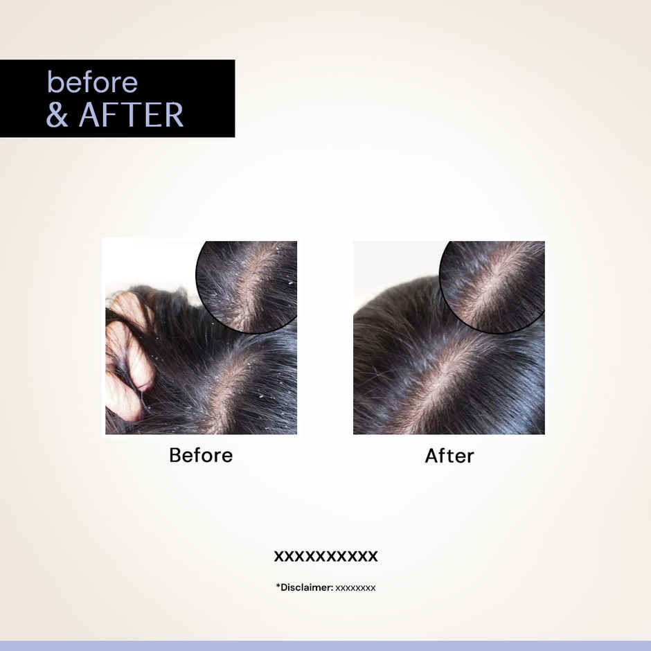 Deconstruct Anti Dandruff Serum | 0.5% Piroctone Olamine, 2% Salicylic Acid | Controls Flakes