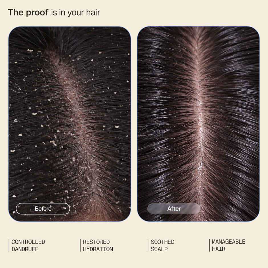 Arata Anti-Dandruff Conditioner with Piroctone Olamine & Salicylic Acid for Dandruff Reduction