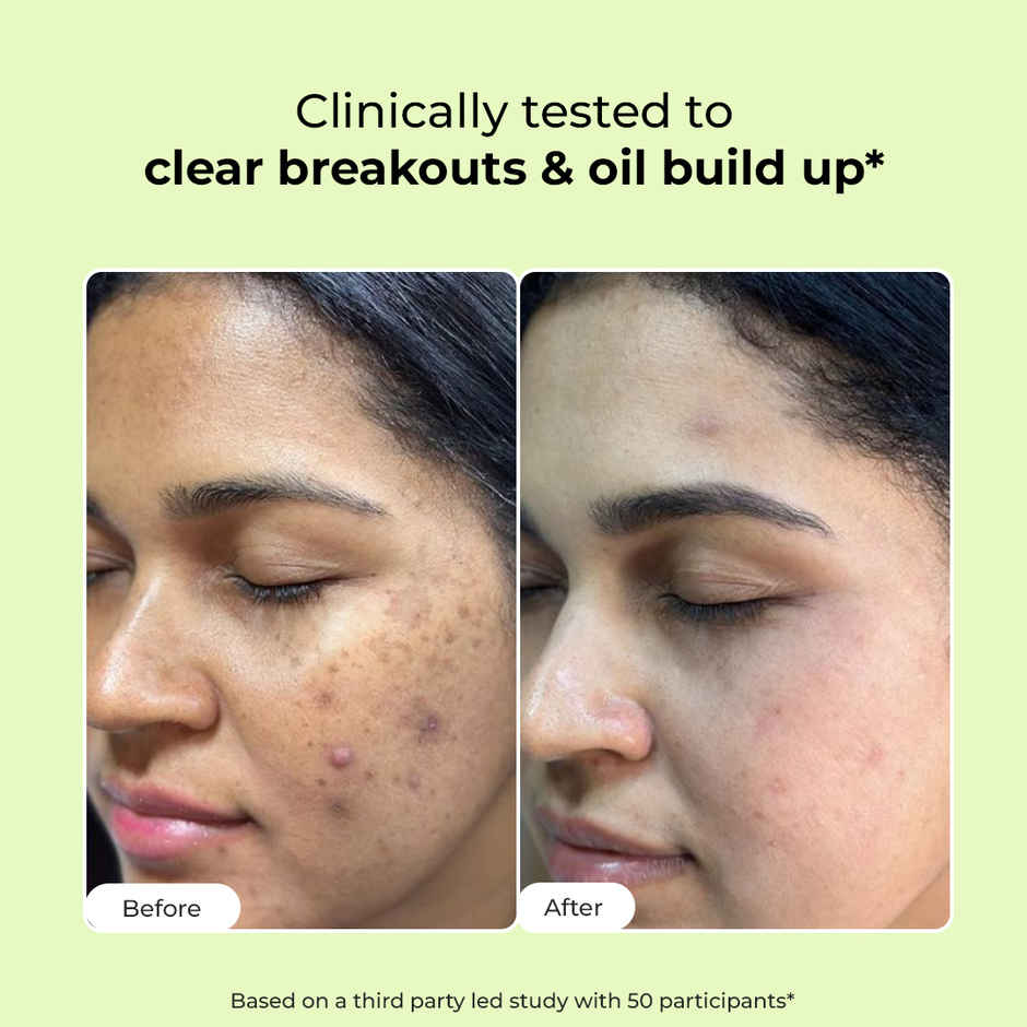 Conscious Chemist Salicylic Acid Face Wash For Oily Acne Prone Skin With Glycolic Acid