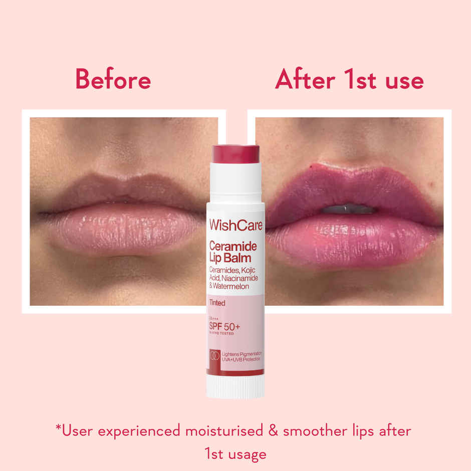 WishCare Tinted Ceramide Lip Balm SPF 50 PA+++ | Niacinamide & Kojic Acid | Protects & Moisturizes