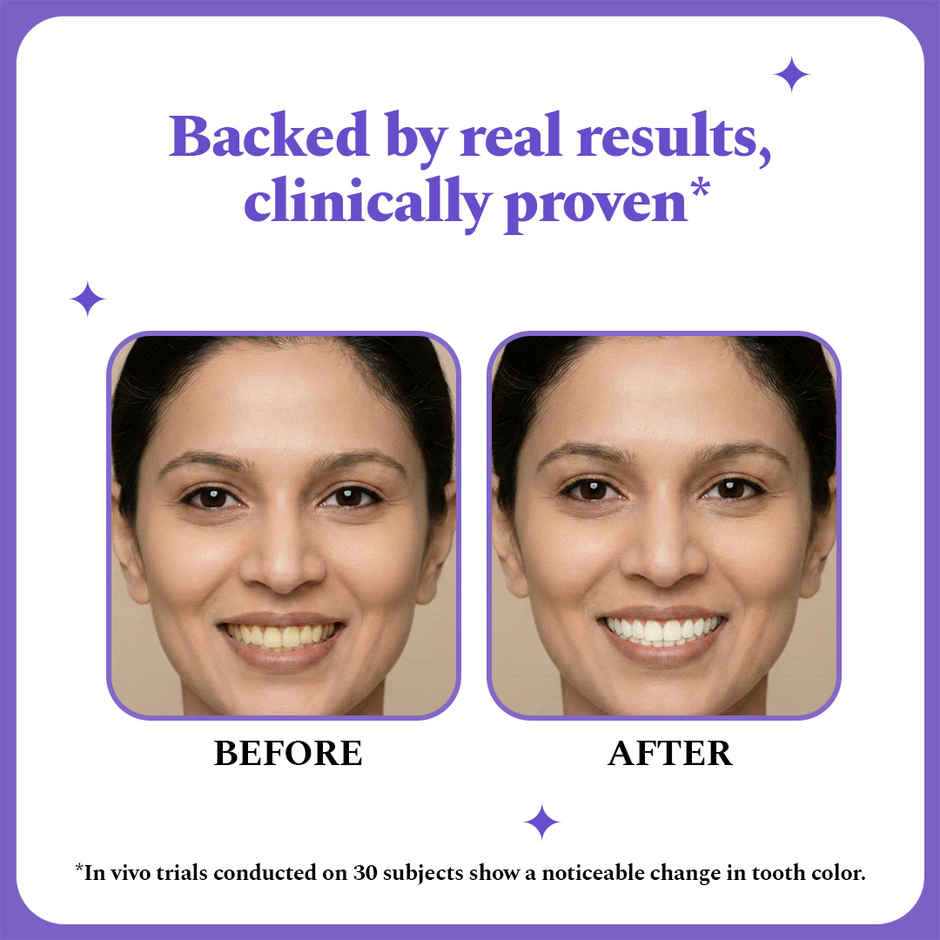 Perfora Purple Teeth Whitening Strips | 3 treatments 6 Strips