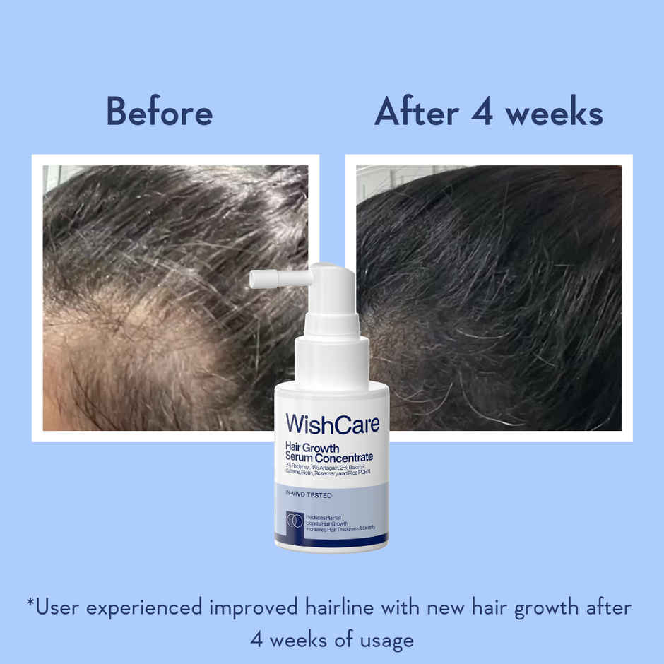 WishCare Hair Growth Serum Concentrate | New Hair Growth in 8 weeks | Redensyl, Anagain & Rosemary