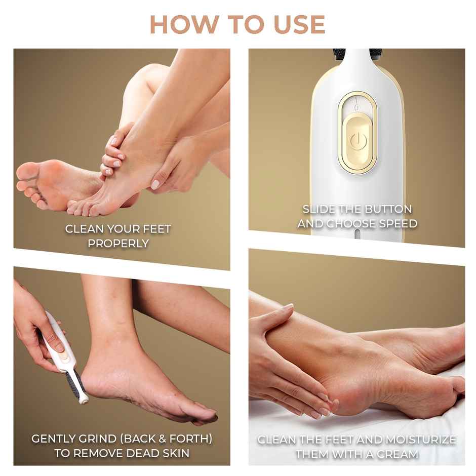 Winston Callus Remover For Feet For Men And Women