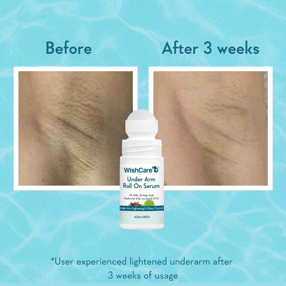 WishCare Underarm Roll On Serum | 5% AHA & 3% Kojic Acid | Underarm Lightening & Odour Control