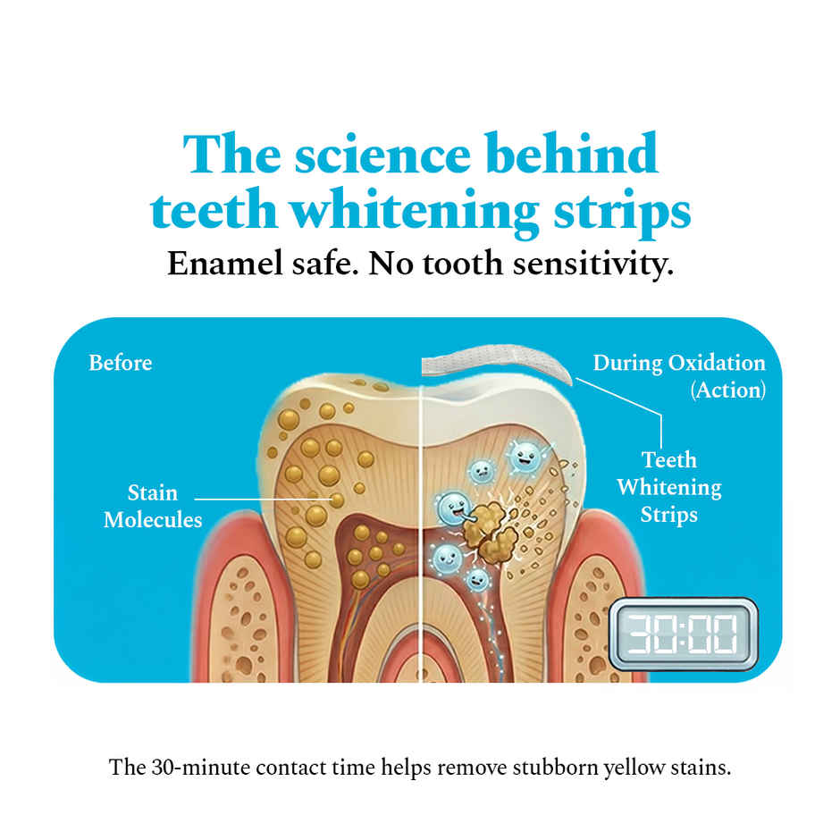 Perfora Teeth Whitening Strips | Classic Mint