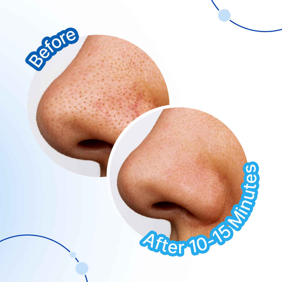 Sotrue Aloe Vera & Activated Charcoal Nose Pore Deep Cleansing Strips