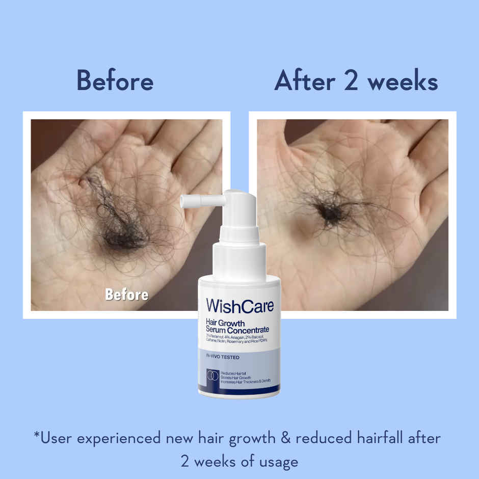 WishCare Hair Growth Serum Concentrate | New Hair Growth in 8 weeks | Redensyl, Anagain & Rosemary