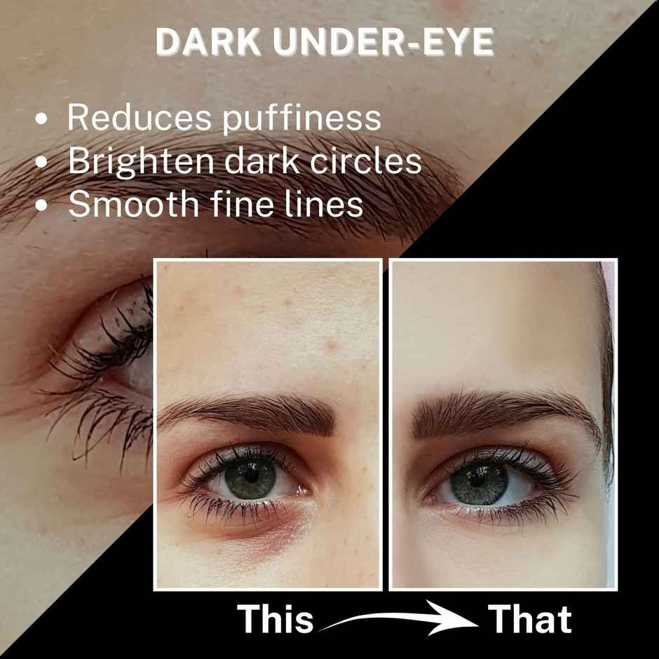 House Of Beauty Hot Cold Gel Eye Mask For Soothing Relief Puffy Eyes Dark Circle & Stress