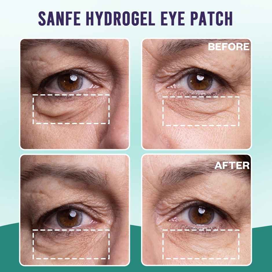 Sanfe Hydrogel Eye Patch | 15 min treatment | Reduces dark circle, puffiness, wrinkles | 3 Pairs
