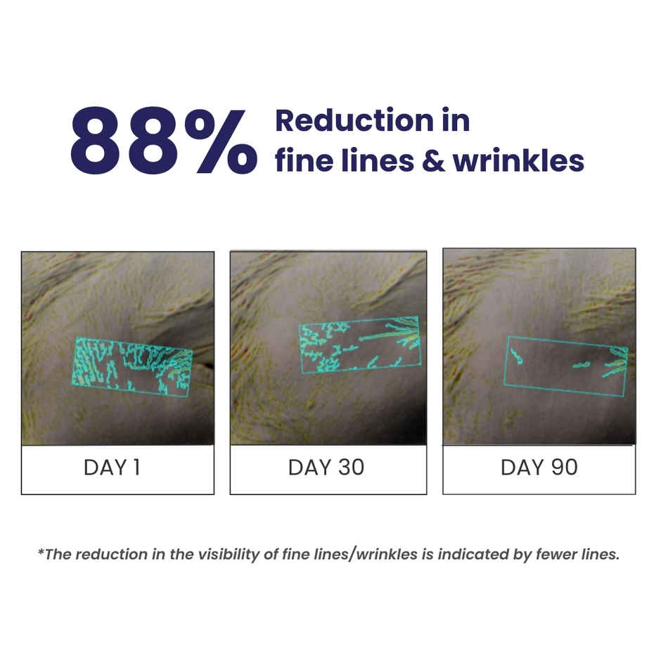 Buy Re'equil 0.1% Retinol Night Cream for Wrinkles & Skin Tightening ...
