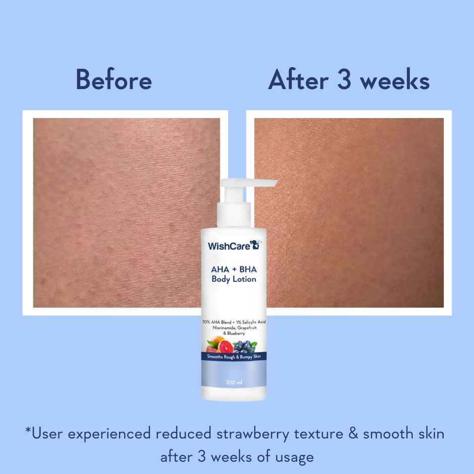WishCare 10% AHA + 1% BHA Body Lotion | Smooths Rough & Bumpy Skin | With Grapefruit & Blueberry
