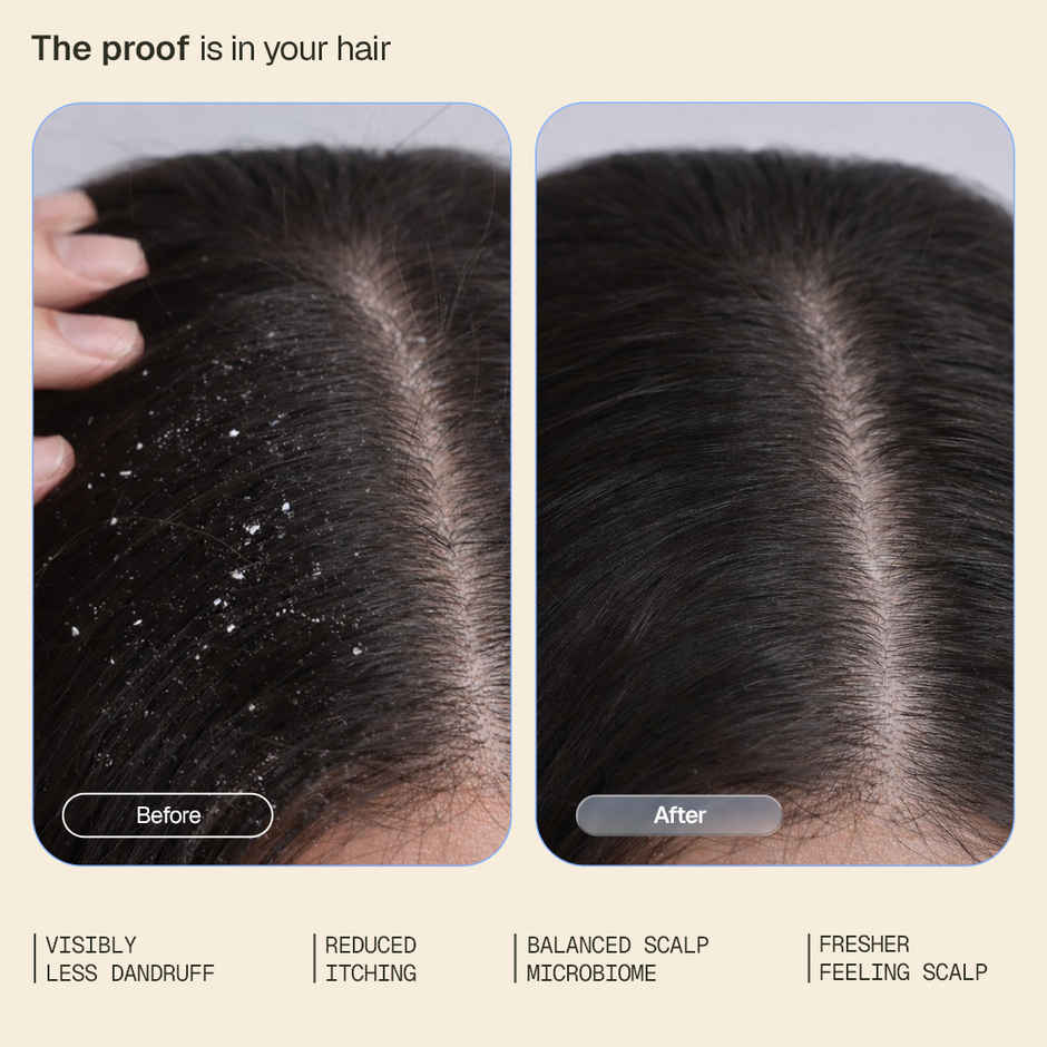 Arata Anti-Dandruff Shampoo with Piroctone Olamine & Salicylic Acid for Dandruff Reduction
