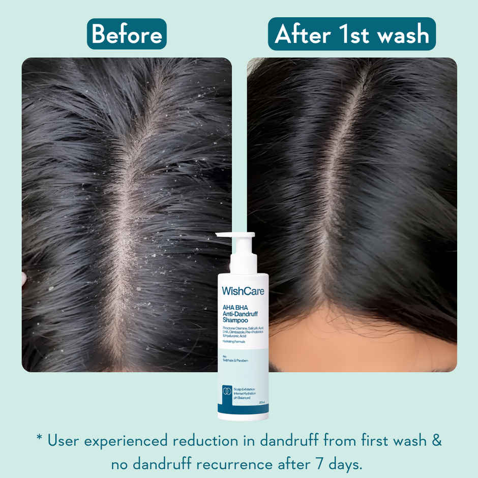 WishCare Hydrating AHA BHA Anti Dandruff Shampoo | 100% Dandruff Reduction-Paraben & Sulphate Free