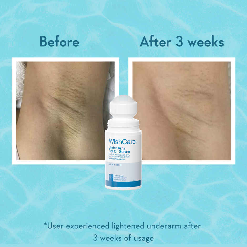 WishCare Underarm Roll On Serum | 5% AHA & 3% Kojic Acid | Underarm Lightening & Odour Control