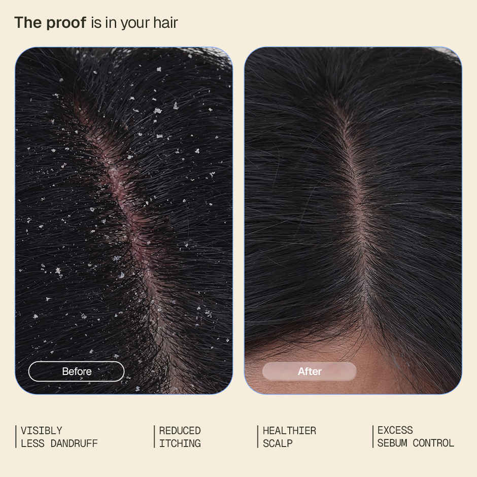 Arata Anti-Dandruff Serum | Controls Dandruff & Itch | Leave-on Serum